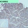 antibody-dmc100832 adam9 ihc1