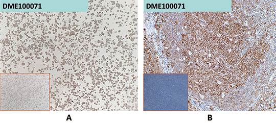dme100071-msln-ihc1.jpg
