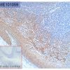 antibody-dme101059 her3 ihc1