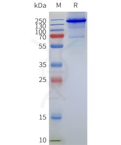 page-flp120128a mbp trpv1 strep sp1