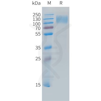 sp-PME C100033 CEACAM5 Fig.1 SDS PAGE 1