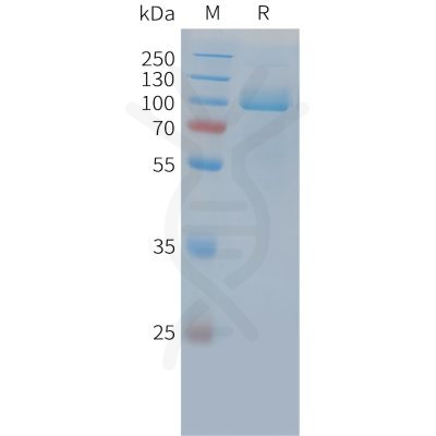 sp-PME C100035 PSMA Fig.1 SDS PAGE 1