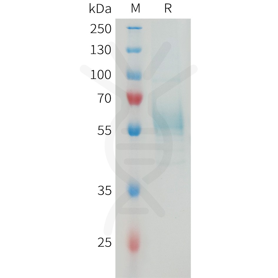 sp-PME M100080 TREM2 Fig.1 SDS PAGE 1