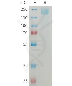 sp-PME M100083 SEZ6 Fig.1 SDS PAGE 1
