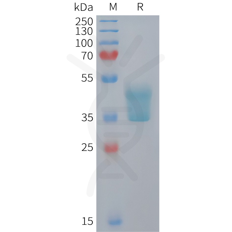 sp-PME M100107 CCR2 Fig.1 SDS PAGE 1