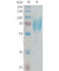 sp-PME101335 NTRK2 Fig.1 SDS PAGE 1 1