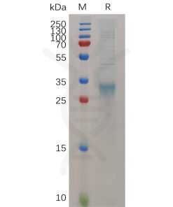 sp-pme m100017 ifnb1 sp1