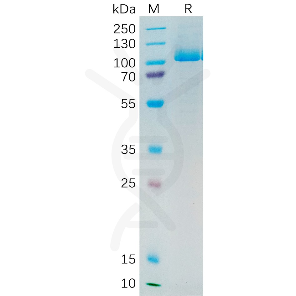 sp-pme100545 psma sp1