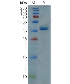 sp-pme100666 gfap sp1