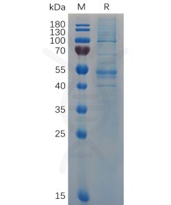 sp-pme100682 ifnb1 sp1