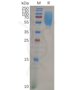 sp-pme100831 ceacam1 sp1