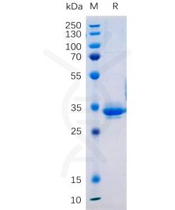 sp-pme101070 tm4sf1 sp1