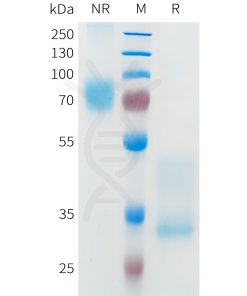 sp-pme101654 met sp1