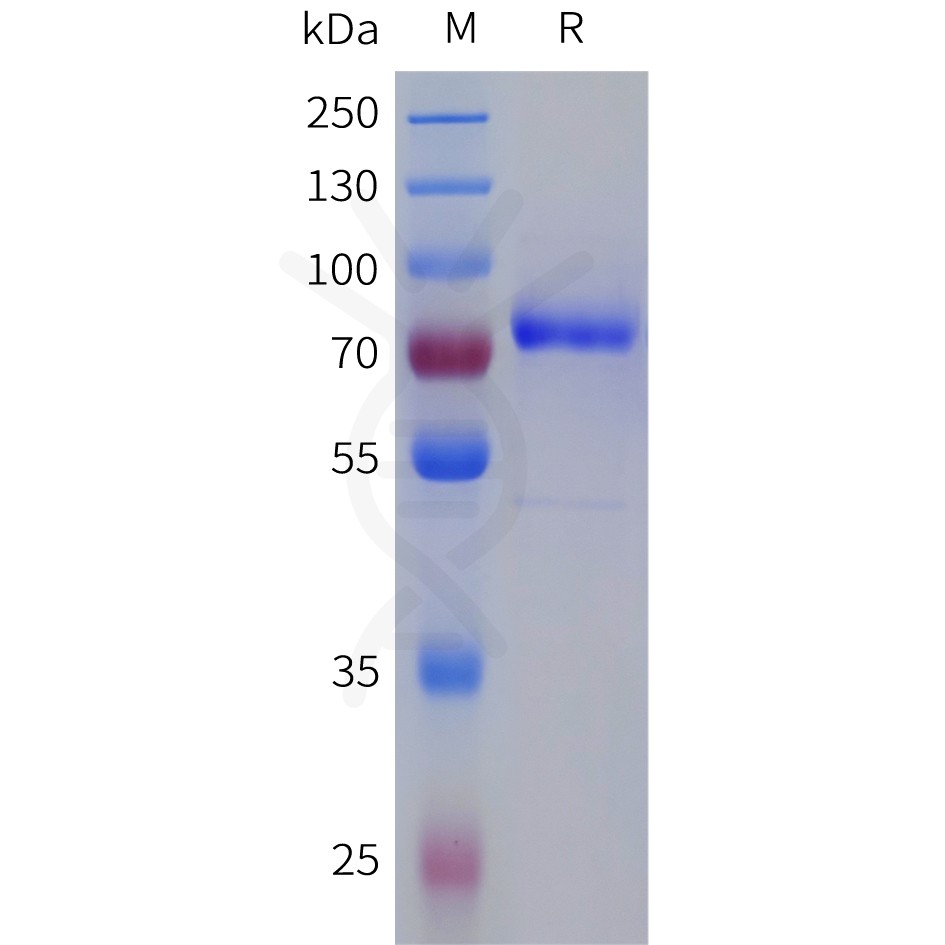 sp-pme101748 f11 sp1