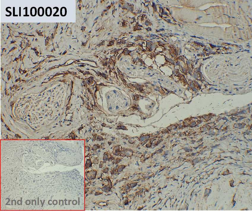 ihc-sli100020 t47 d ihc1